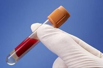 乙肝全身表現(xiàn)有哪些癥狀？