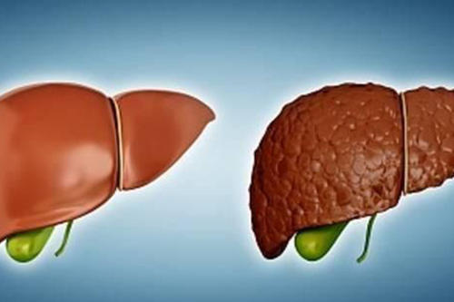 乙肝怎么檢查？